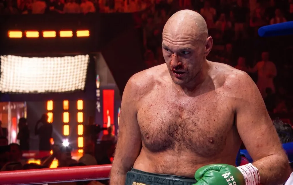 Tyson Fury977